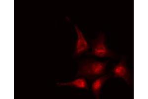 ABIN6267657 staining HeLa by IF/ICC. (NFKBIB antibody  (pSer19))