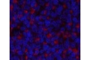 Immunofluorescence analysis of Rat spleen tissue using JAK2 Polyclonal Antibody at dilution of 1:200. (JAK2 antibody)
