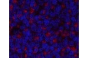 Immunofluorescence analysis of Rat spleen tissue using JAK2 Polyclonal Antibody at dilution of 1:200.