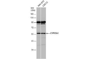 WB Image Various whole cell extracts (30 μg) were separated by 10% SDS-PAGE, and the membrane was blotted with CYP17A1 antibody [N1C2] , diluted at 1:1000. (CYP17A1 antibody  (Center))