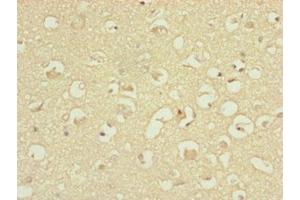 Immunohistochemistry of paraffin-embedded human brain tissue using ABIN7144845 at dilution of 1:100 (ATP5H antibody  (AA 1-161))