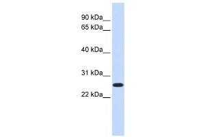 Western Blotting (WB) image for anti-CTD Nuclear Envelope Phosphatase 1a (CTDNEP1A) antibody (ABIN2459072) (CTDNEP1A antibody)