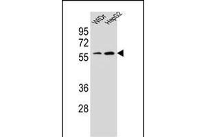 HOXA10 Antibody (Center) (ABIN654234 and ABIN2844067) western blot analysis in WiDr,HepG2 cell line lysates (35 μg/lane).