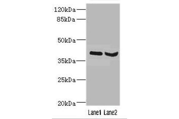 HOXD1 antibody  (AA 1-240)