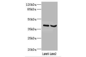 Western blot All lanes: HOXD10 antibody at 3. (HOXD1 antibody  (AA 1-240))