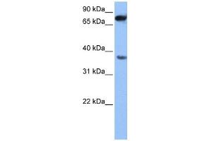 ZCCHC12 antibody used at 1 ug/ml to detect target protein. (ZCCHC12 antibody  (N-Term))