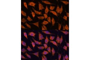 Immunofluorescence analysis of L929 cells using KIF13A antibody (ABIN7268122) at dilution of 1:100. (KIF13A antibody  (AA 1300-1600))