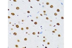 Immunohistochemistry of paraffin-embedded Rat brain using DDX39B Polyclonal Antibody at dilution of 1:100 (40x lens).