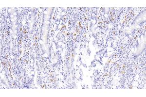 Detection of IBA1 in Human Small intestine Tissue using Monoclonal Antibody to Ionized Calcium-binding Adapter Molecule 1 (IBA1) (Iba1 antibody  (AA 1-147))