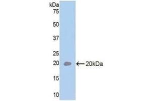 Detection of Recombinant IL33, Rat using Polyclonal Antibody to Interleukin 33 (IL33) (IL-33 antibody  (AA 110-261))