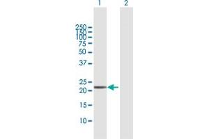 TXNDC9 antibody  (AA 1-188)