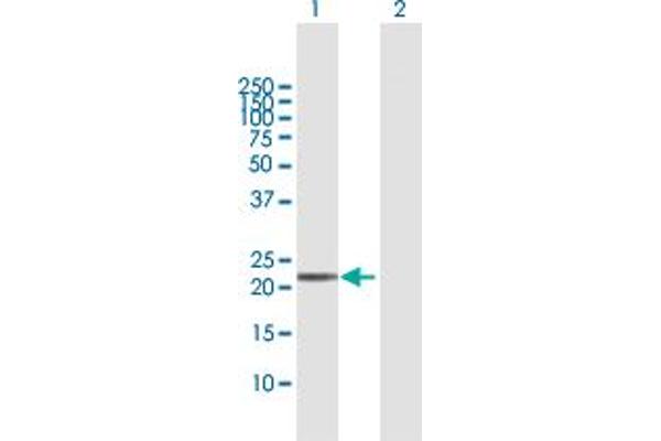 TXNDC9 antibody  (AA 1-188)