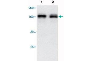 Western blot analysis in Lane 1: HeLa vell lysate and Lane 2: A-549 cell lysate with NEDD9 monoclonal antibody, clone C7. (NEDD9 antibody  (AA 82-398))