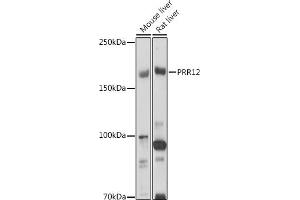 Western blot analysis of extracts of various cell lines, using PRR12 antibody (ABIN7269553) at 1:1000 dilution. (Proline Rich 12 antibody)