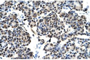 Human Pancrease lysate (HOXB5 antibody  (N-Term))
