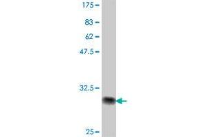 Western Blot detection against Immunogen (32. (IRX1 antibody  (AA 424-479))