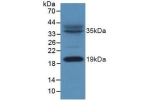 Detection of ACP in Mouse Heart Tissue using Polyclonal Antibody to Acyl Carrier Protein, Mitochondrial (ACP) (NDUFAB1 antibody  (AA 5-129))
