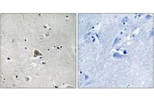 Immunohistochemistry analysis of paraffin-embedded human brain tissue, using Claudin 4 (Ab-208) Antibody. (Claudin 4 antibody  (AA 160-209))