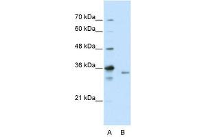 EXOSC3 antibody used at 2.