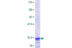 Histone H1 Protein (AA 42-95) (GST tag)