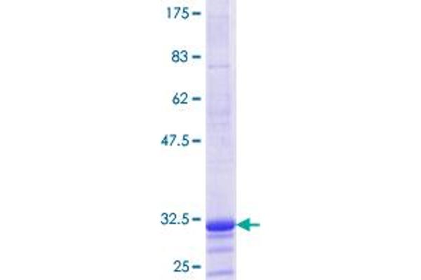 Histone H1 Protein (AA 42-95) (GST tag)