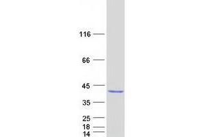 Validation with Western Blot