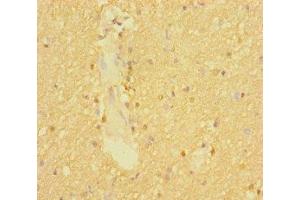 Immunohistochemistry of paraffin-embedded human brain tissue using ABIN7170007 at dilution of 1:100 (SLC6A7 antibody  (AA 557-636))