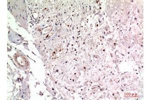 Immunohistochemistry (IHC) analysis of paraffin-embedded Human Colon, antibody was diluted at 1:100. (ITGA2 antibody  (Internal Region))