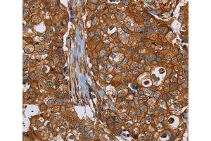 Immunohistochemistry (IHC) image for anti-Plectin (PLEC) antibody (ABIN2433604) (PLEC antibody)