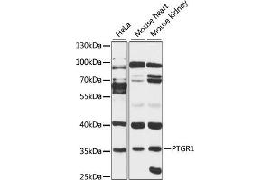 Western blot analysis of extracts of various cell lines, using PTGR1 antibody (ABIN6129622, ABIN6146411, ABIN6146412 and ABIN6220671) at 1:3000 dilution. (PTGR1 antibody  (AA 1-115))