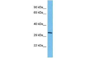 Host: Rabbit Target Name: TMEM202 Sample Type: HepG2 Whole Cell lysates Antibody Dilution: 1. (TMEM202 antibody  (C-Term))