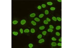 Immunocytochemistry staining of HeLa cells fixed with 4 % Paraformaldehyde and using anti-K / TIF1 beta mouse mAb (dilution 1:100). (KAP1 antibody)