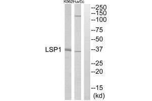 Western Blotting (WB) image for anti-Lymphocyte-Specific Protein 1 (LSP1) (Internal Region) antibody (ABIN1851512) (LSP1 antibody  (Internal Region))