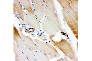 Anti-IRS1 antibody, (ABIN3043251), IHC(P)IHC(P): Rat Skeletal Muscle Tissue (IRS1 antibody  (AA 1041-1242))