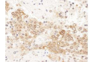 Immunohistochemistry (IHC) image for anti-Chloride Channel, Nucleotide-Sensitive, 1A (CLNS1A) (AA 187-237) antibody (ABIN7455042) (CLNS1A antibody  (AA 187-237))