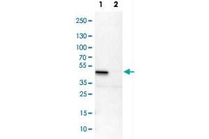Western Blot analysis of Lane 1: NIH-3T3 cell lysate (mouse embryonic fibroblast cells) and Lane 2: NBT-II cell lysate (Wistar rat bladder tumor cells) with ILKAP polyclonal antibody .