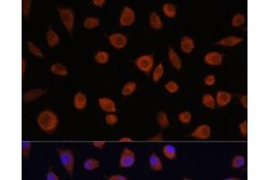 Immunofluorescence analysis of L929 cells using ZCCHC3 Polyclonal Antibody at dilution of 1:100. (ZCCHC3 antibody)