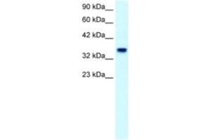 Western Blotting (WB) image for anti-Forkhead Box F1 (FOXF1) antibody (ABIN2460416)