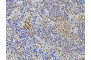 ABIN6275021 at 1/100 staining Human lymph node tissue by IHC-P. (ST6GAL1 antibody  (Internal Region))