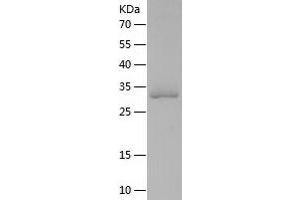 Western Blotting (WB) image for Spindle and Kinetochore Associated Complex Subunit 1 (SKA1) (AA 1-255) protein (His tag) (ABIN7288271) (SKA1 Protein (AA 1-255) (His tag))