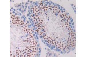 Used in DAB staining on fromalin fixed paraffin- embedded testis tissue (DTYMK antibody  (AA 43-190))