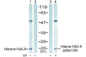 Image no. 1 for anti-H2A Histone Family, Member X (H2AFX) (pSer139) antibody (ABIN197033) (H2AFX antibody  (pSer139))