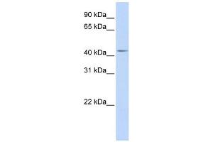 WB Suggested Anti-DENND1B Antibody Titration: 0. (DENND1B antibody  (Middle Region))