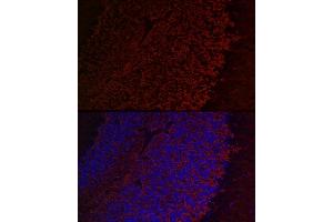 Immunofluorescence analysis of mouse brain cells using Aquaporin-4  Rabbit pAb (ABIN3016920, ABIN3016921, ABIN3016922 and ABIN6219881) at dilution of 1:50 (40x lens). (Aquaporin 4 antibody  (AA 244-323))