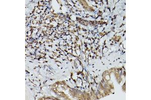 Immunohistochemistry (IHC) image for anti-Proteolipid Protein 1 (PLP1) (AA 145-210) antibody (ABIN7269724)