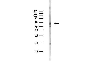 anti-Methyl CpG Binding Protein 2 (MECP2) (pSer423) antibody