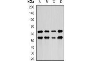 Western blot analysis of LIM expression in HepG2 (A), MCF7 (B), mouse lung (C), mouse kidney (D) whole cell lysates. (PDLIM5 antibody)