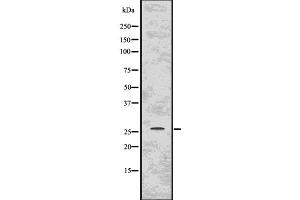 Western blot analysis of PPP1R1A using COS7 whole  lysates. (PPP1R1A antibody)