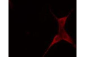 ABIN6274678 staining COLO205 cells by IF/ICC. (BCL2L2 antibody  (N-Term))