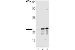 Western blot analysis of MnSOD pAb: Lane 1: HeLa Cell Lysate, Lane 2: Rat Brain Tissue Extract, Lane 3: Mouse Brain Tissue Extract (SOD2 antibody)
